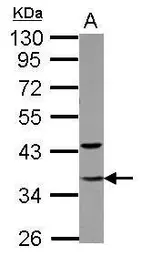 Anti-TFIIE beta antibody used in Western Blot (WB). GTX105029