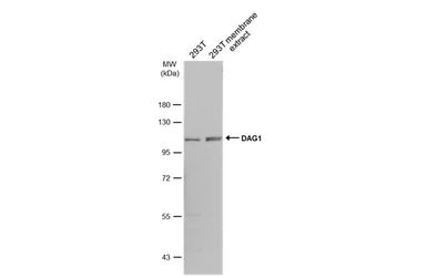 Anti-DAG1 antibody used in Western Blot (WB). GTX105038