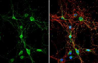 Anti-DAG1 antibody used in Immunocytochemistry/ Immunofluorescence (ICC/IF). GTX105038