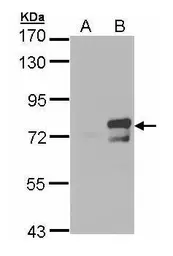 Anti-BMAL1 antibody [N1N3] used in Western Blot (WB). GTX105060