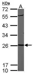 Anti-PSMA6 antibody used in Western Blot (WB). GTX105061