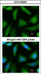 Anti-PSMA6 antibody used in Immunocytochemistry/ Immunofluorescence (ICC/IF). GTX105061