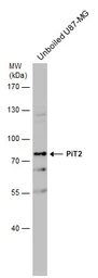 Anti-PiT2 antibody [N2C1], Internal used in Western Blot (WB). GTX105078