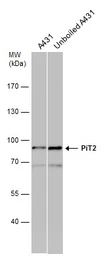 Anti-PiT2 antibody [N2C1], Internal used in Western Blot (WB). GTX105078