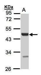 Anti-UST antibody [N1C3] used in Western Blot (WB). GTX105084