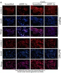 Anti-LOXL2 antibody used in Immunocytochemistry/ Immunofluorescence (ICC/IF). GTX105085