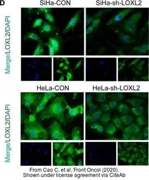 Anti-LOXL2 antibody used in Immunocytochemistry/ Immunofluorescence (ICC/IF). GTX105085