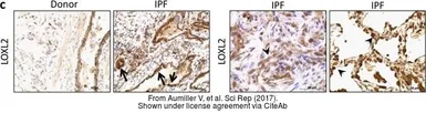 Anti-LOXL2 antibody used in IHC (Paraffin sections) (IHC-P). GTX105085