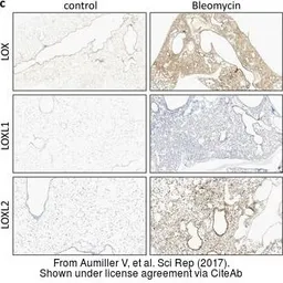 Anti-LOXL2 antibody used in IHC (Paraffin sections) (IHC-P). GTX105085