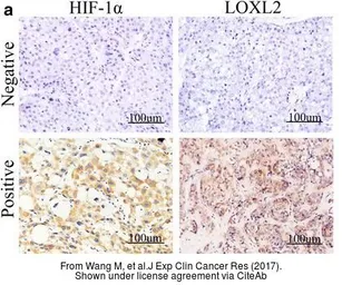 Anti-LOXL2 antibody used in IHC (Paraffin sections) (IHC-P). GTX105085