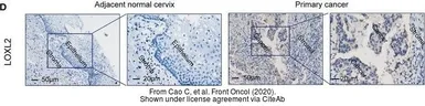 Anti-LOXL2 antibody used in IHC (Paraffin sections) (IHC-P). GTX105085