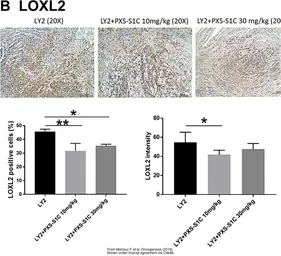 Anti-LOXL2 antibody used in IHC (Paraffin sections) (IHC-P). GTX105085