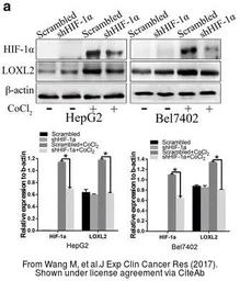 Anti-LOXL2 antibody used in Western Blot (WB). GTX105085