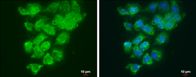 Anti-LOXL2 antibody used in Immunocytochemistry/ Immunofluorescence (ICC/IF). GTX105085