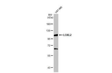 Anti-LOXL2 antibody used in Western Blot (WB). GTX105085