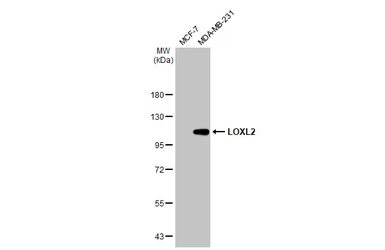 Anti-LOXL2 antibody used in Western Blot (WB). GTX105085