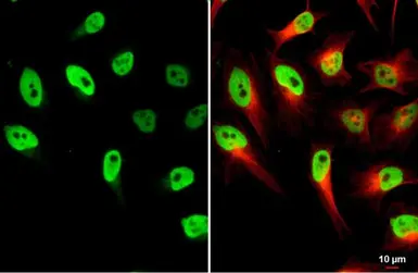 Anti-LOXL2 antibody used in Immunocytochemistry/ Immunofluorescence (ICC/IF). GTX105085