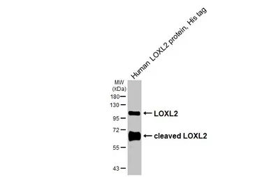 Anti-LOXL2 antibody used in Western Blot (WB). GTX105085