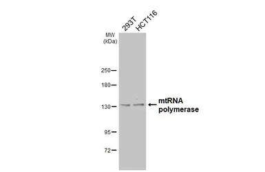 Anti-mtRNA polymerase antibody [N2N3] used in Western Blot (WB). GTX105137