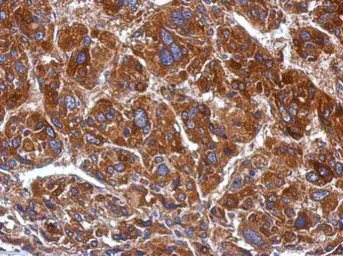 Anti-mtRNA polymerase antibody [N2N3] used in IHC (Paraffin sections) (IHC-P). GTX105137