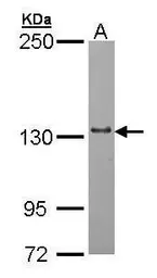 Anti-mtRNA polymerase antibody [N2N3] used in Western Blot (WB). GTX105137