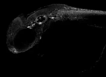 Anti-Hexokinase 1 antibody used in IHC (Whole mount) (IHC-Wm). GTX105248