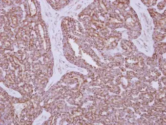 Anti-Hexokinase 1 antibody used in IHC (Paraffin sections) (IHC-P). GTX105248