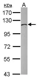 Anti-Hexokinase 1 antibody used in Western Blot (WB). GTX105248