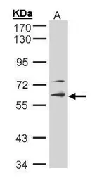 Anti-STK33 antibody [N1C1] used in Western Blot (WB). GTX105293