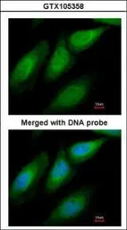 Anti-SUGT1 antibody [N1C3] used in Immunocytochemistry/ Immunofluorescence (ICC/IF). GTX105358