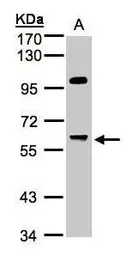 Anti-PPP1R16A antibody [N1C3] used in Western Blot (WB). GTX105410