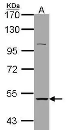 Anti-AChR alpha 3 antibody used in Western Blot (WB). GTX105495