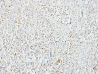 Anti-MIPEP antibody [N2C1], Internal used in IHC (Paraffin sections) (IHC-P). GTX105574