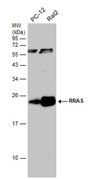 Anti-RRAS antibody [N1C3] used in Western Blot (WB). GTX105575