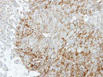 Anti-RRAS antibody [N1C3] used in IHC (Paraffin sections) (IHC-P). GTX105575