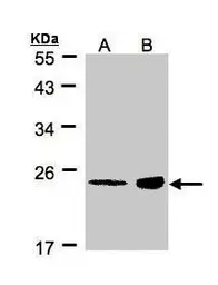 Anti-RRAS antibody [N1C3] used in Western Blot (WB). GTX105575