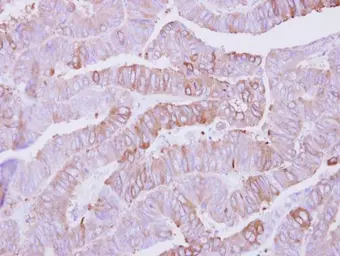 Anti-Casein Kinase 1 alpha 1L antibody used in IHC (Paraffin sections) (IHC-P). GTX105584