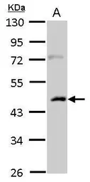 Anti-Casein Kinase 1 alpha 1L antibody used in Western Blot (WB). GTX105584