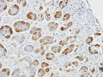 Anti-GSAT1 / GSAT2 / GSAT3 antibody used in IHC (Paraffin sections) (IHC-P). GTX105600