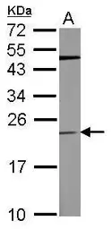 Anti-TCTP antibody [N1C3] used in Western Blot (WB). GTX105601