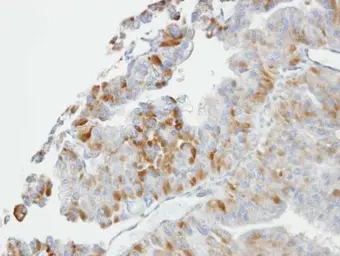 Anti-GSTO1 antibody [N1C3] used in IHC (Paraffin sections) (IHC-P). GTX105655