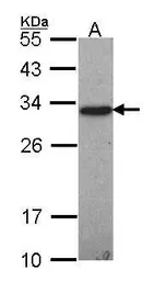 Anti-GSTO1 antibody [N1C3] used in Western Blot (WB). GTX105655