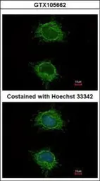 Anti-NDUFS4 antibody used in Immunocytochemistry/ Immunofluorescence (ICC/IF). GTX105662