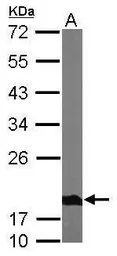 Anti-NDUFS4 antibody used in Western Blot (WB). GTX105662