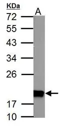 Anti-NDUFS4 antibody used in Western Blot (WB). GTX105662