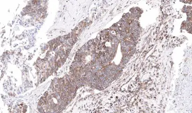 Anti-NDUFS4 antibody used in IHC (Paraffin sections) (IHC-P). GTX105662