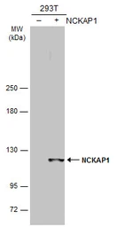 Anti-NCKAP1 antibody [C1C2], Internal used in Western Blot (WB). GTX105682