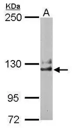 Anti-NCKAP1 antibody [C1C2], Internal used in Western Blot (WB). GTX105682