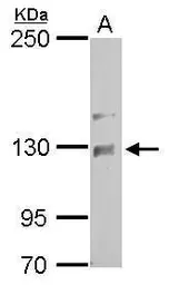 Anti-NCKAP1 antibody [C1C2], Internal used in Western Blot (WB). GTX105682