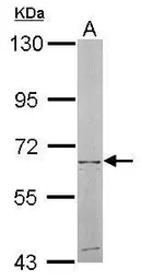 Anti-NT5C2 antibody [N2C1], Internal used in Western Blot (WB). GTX105719